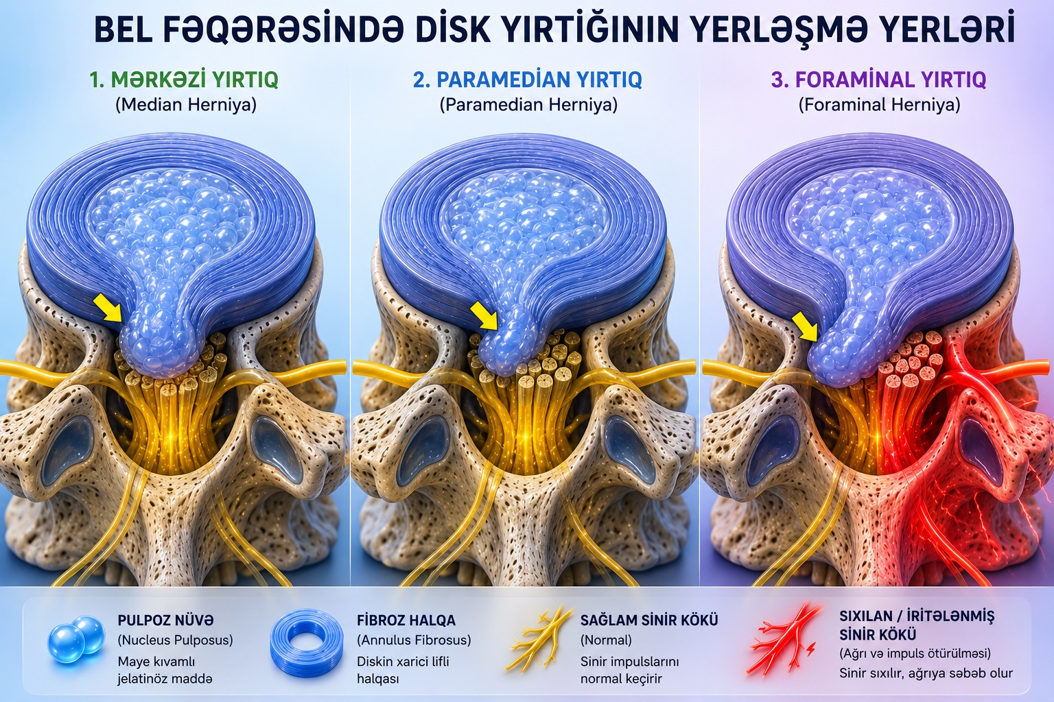 Bel məşqləri